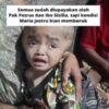 Pilu Bocah 3 Tahun Asal Manggarai Timur: Kepala Maria Terus Membesar, Orangtua Hampir Menyerah karena Biaya Pengobatan